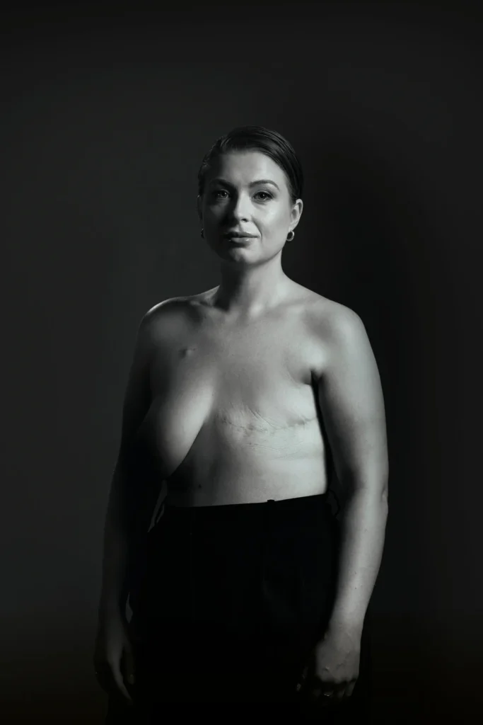 Breast Cancer Ireland - The Generation That Ends This image 2
